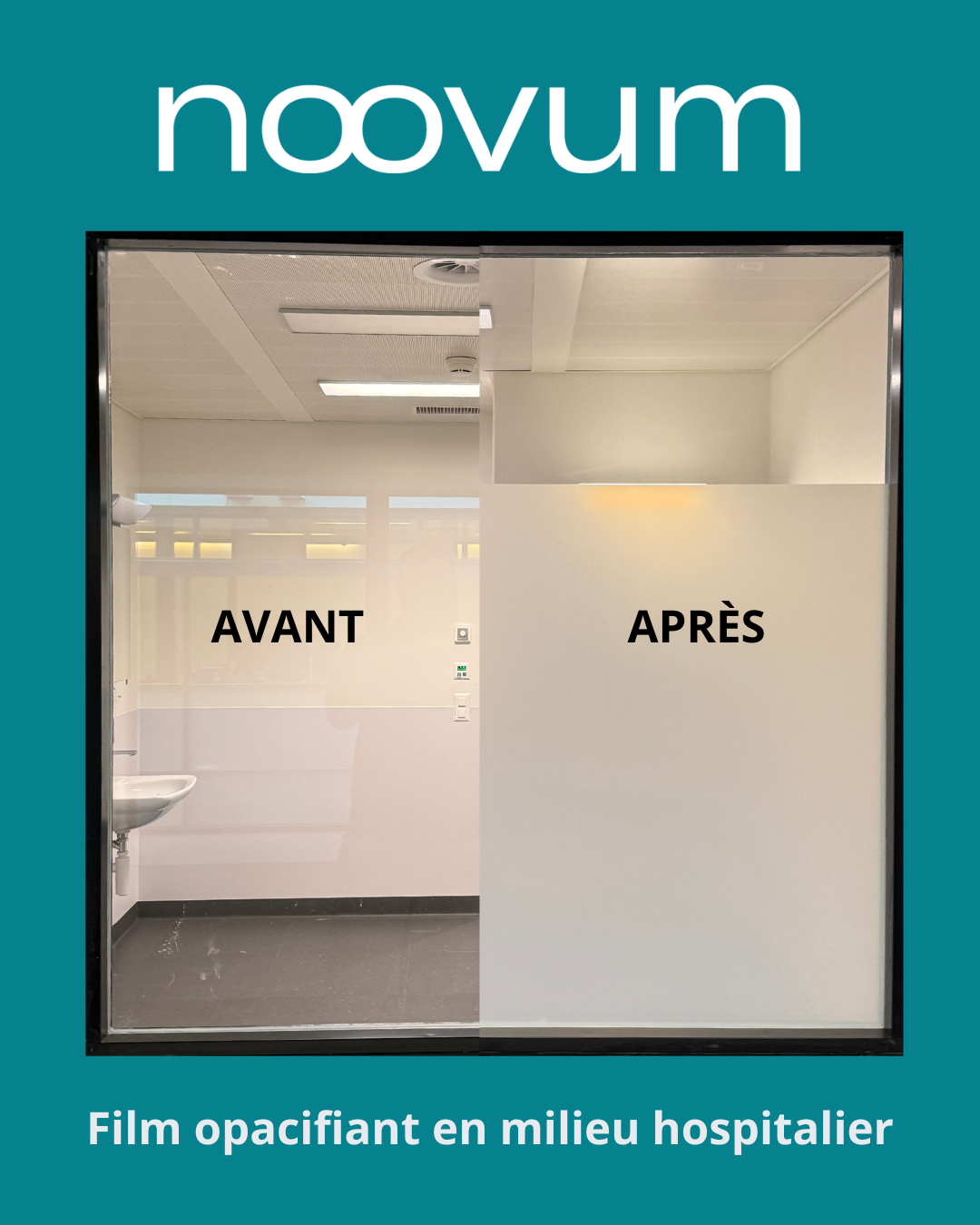 Film opacifiant en hôpital : comment on a posé 4 vitrages en 4h sans interrompre l’activité