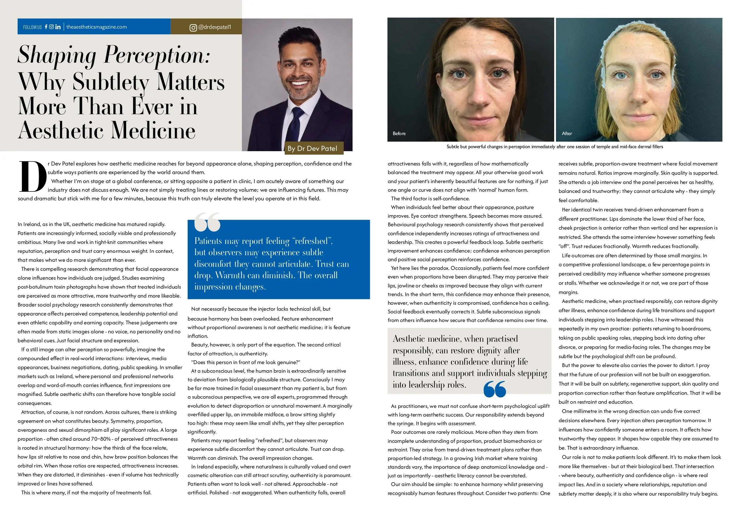 Magazine article titled 'Shaping Perception: Why Subtlety Matters More Than Ever in Aesthetic Medicine' with a photo of a smiling man in a suit, a 'Before' and 'After' picture of a woman showing facial changes after dermal fillers, and blocks of text discussing aesthetic medicine concepts.