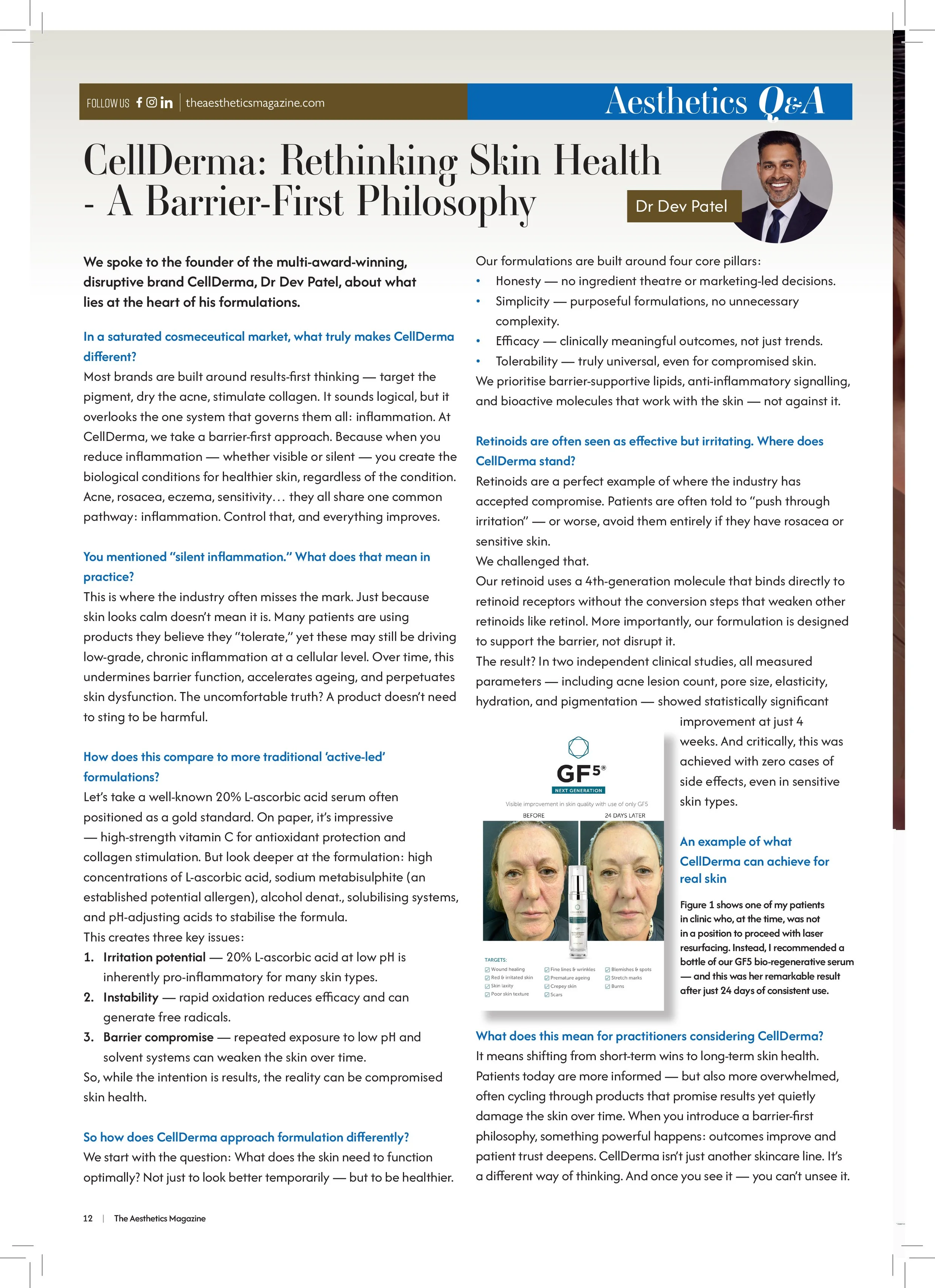 Magazine article layout featuring a profile photo of Dr. Dev Patel, a smiling man in a suit, positioned in the top right corner. The article discusses skin health, inflammation, and the CellDerma brand, with various sections including questions and answers, and product before and after photos.