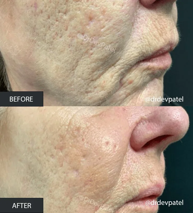 SKIN TEXTURE PLEXR.jpg