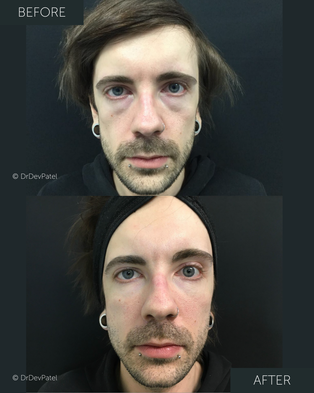 19.png