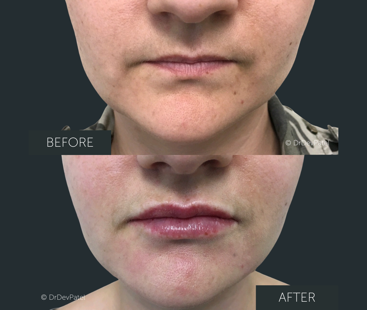 BEFORE (1080 x 1080 px) (1280 x 1080 px) (3).png