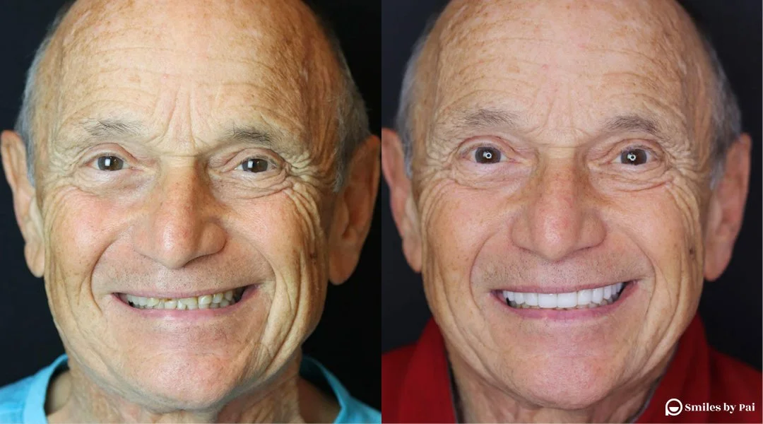 smile makeover_veneers.jpg