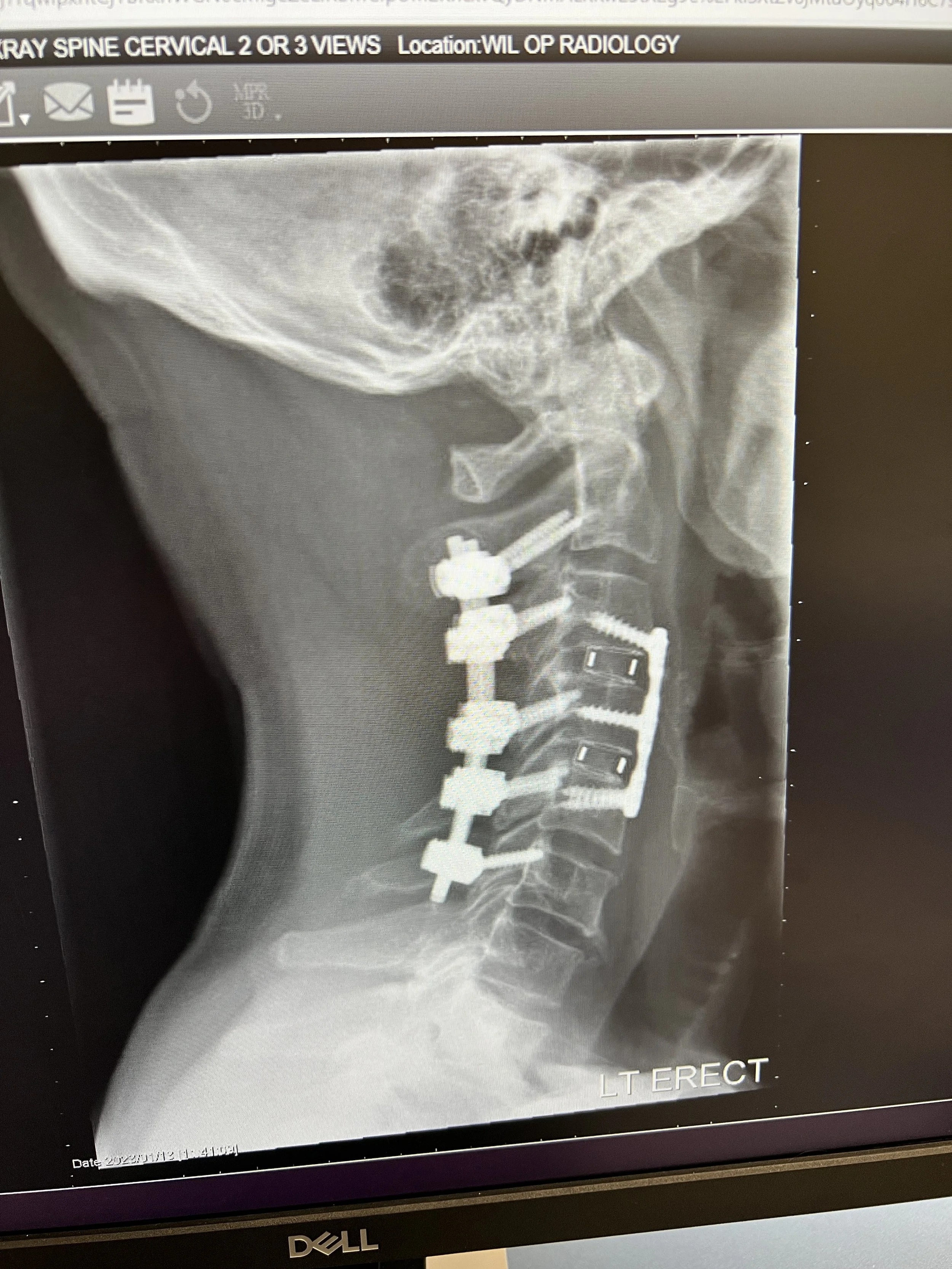 xray.JPG