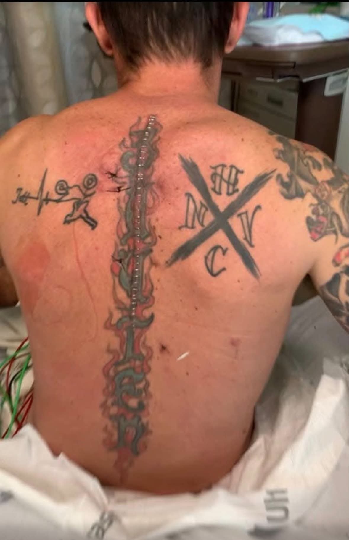 Buyten spine tattoo with staples.jpg