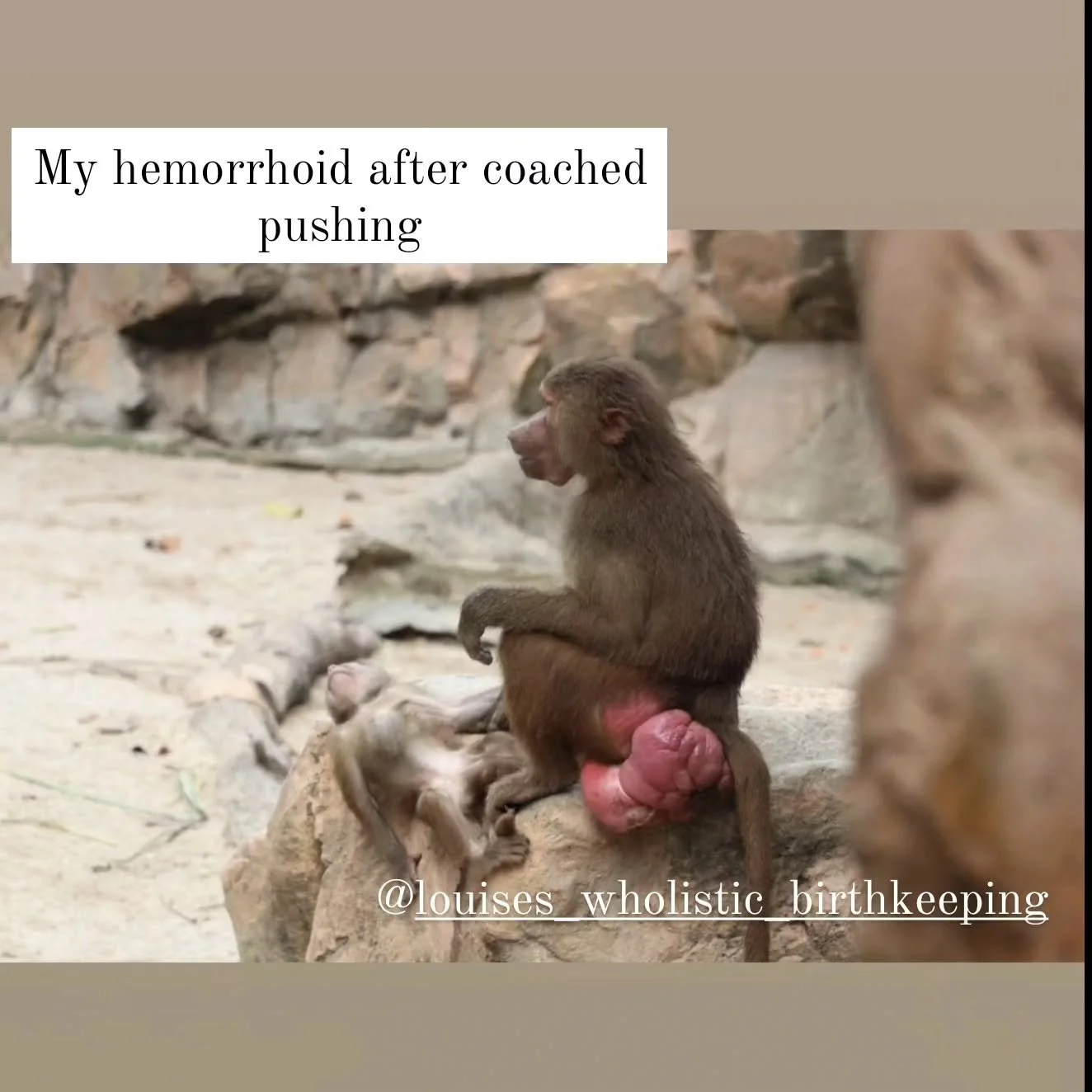 Did you have hemorrhoids like this after your birth too?

Tell me your post partum cow boy stories in the comments 😅 (it's the walk for me)

Okay but seriously natural healing options below? 👇
.
.
.
#hemorrhoidrelief #hemorrhoids #pelvicfloor #post