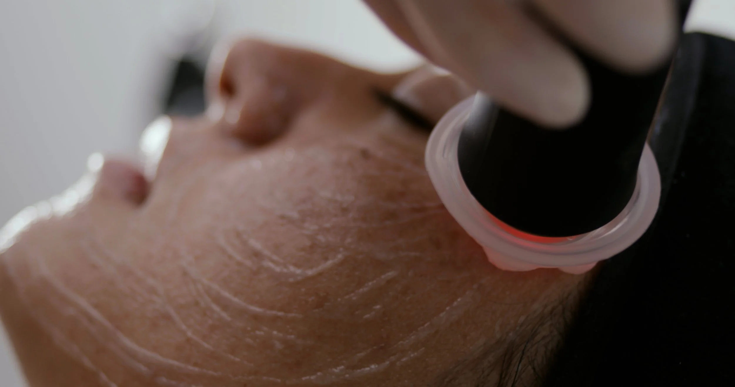JetPeel vs. Glo2Facial: What’s the Difference, and Do You Really Have to Choose Just One?