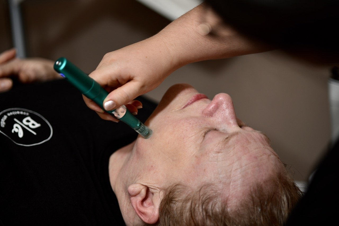 A person lying down receiving a micro needling service for smoother skin, in a clinical setting.