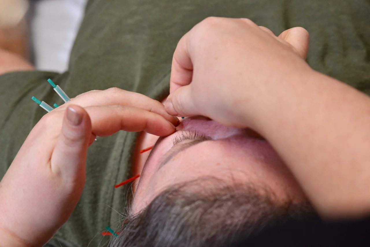 Close-up of a person receiving a vaccination or injection in their upper arm, with medical needles visible.