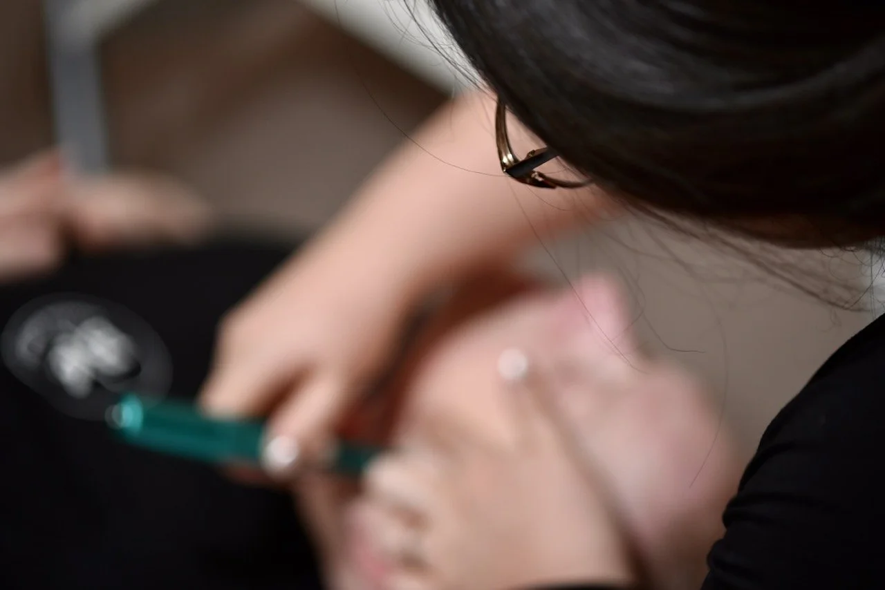 A professional acupuncturist performing micro needling for smoother skin on a woman's face.