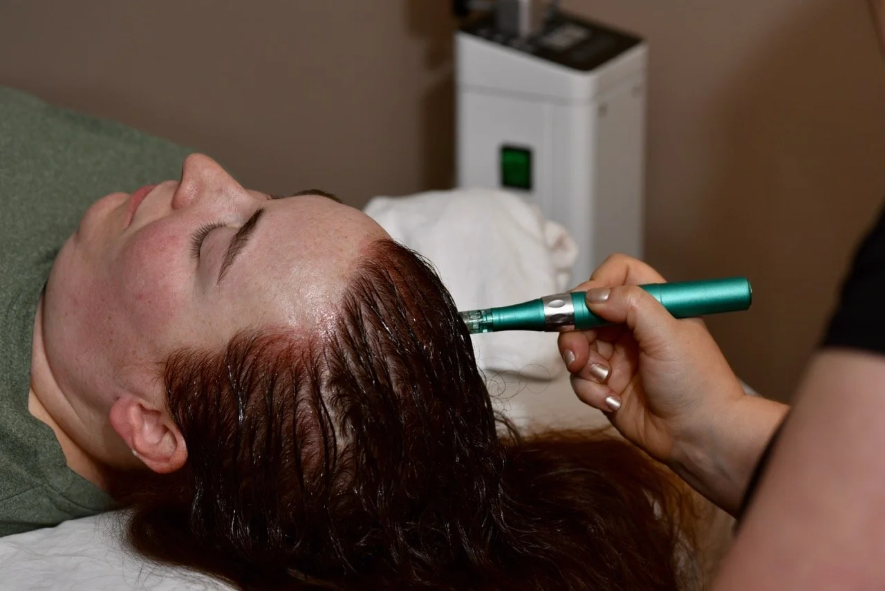 A woman receiving a scalp treatment using a handheld device in a clinical setting.