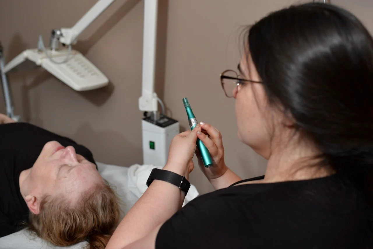 A professional acupuncturist is about to perform micro needling for smoother skin to a woman lying on an acupuncture table.