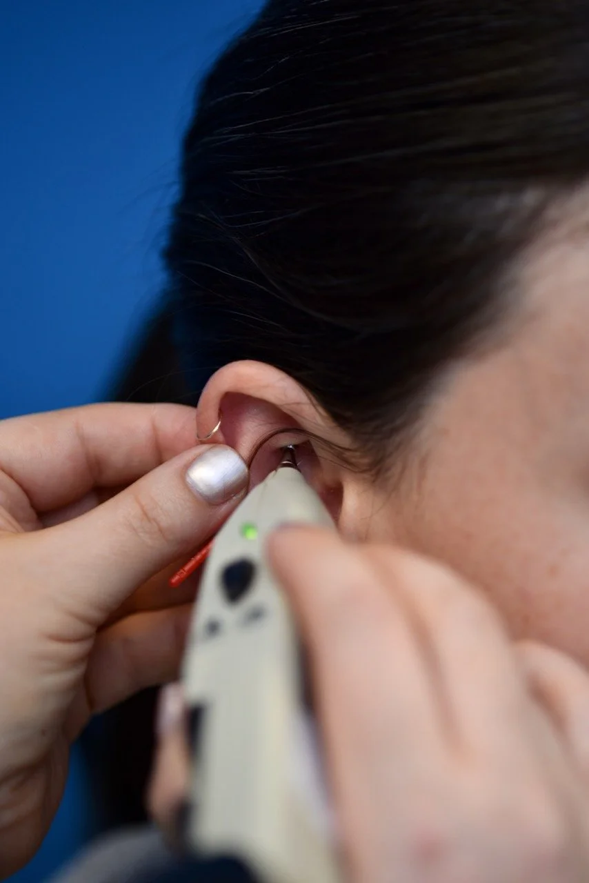 A closeup of a client receiving SAAT treatment by a healthcare professional.