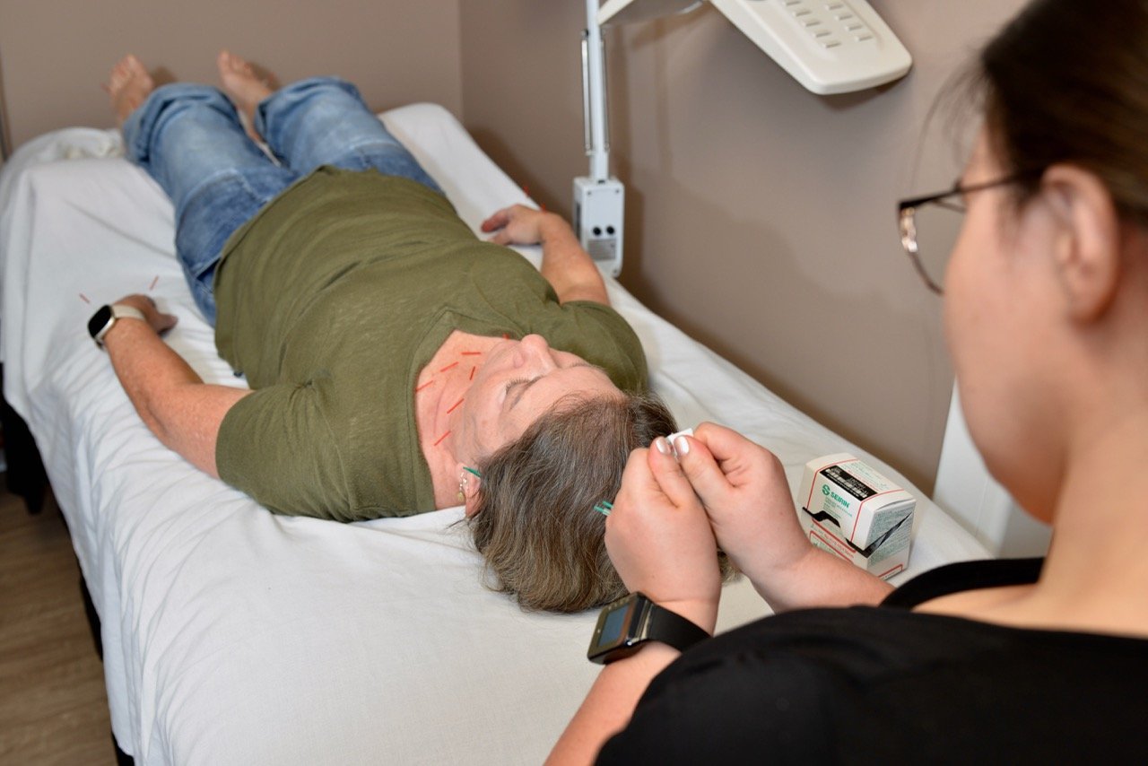 A woman receiving acupuncture treatment on her neck while lying on a hospital bed with a healthcare worker preparing the needles.