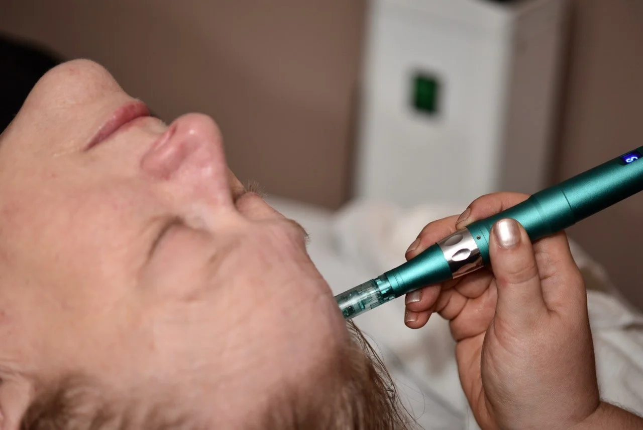 A person receiving a cosmetic treatment with a handheld device on their face in a clinical setting.