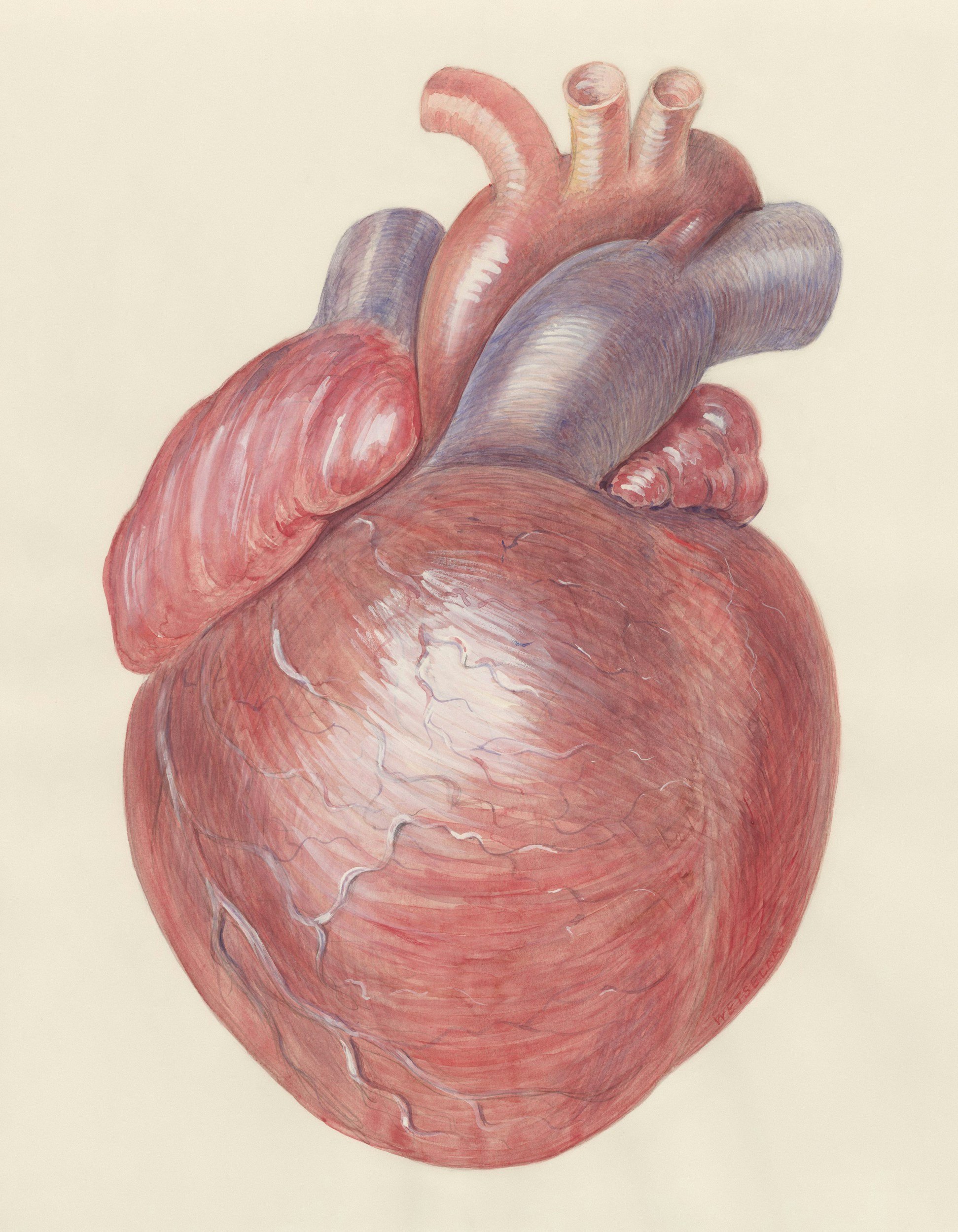 Cardiovascular Health - Coronary Microvascular Dysfunction