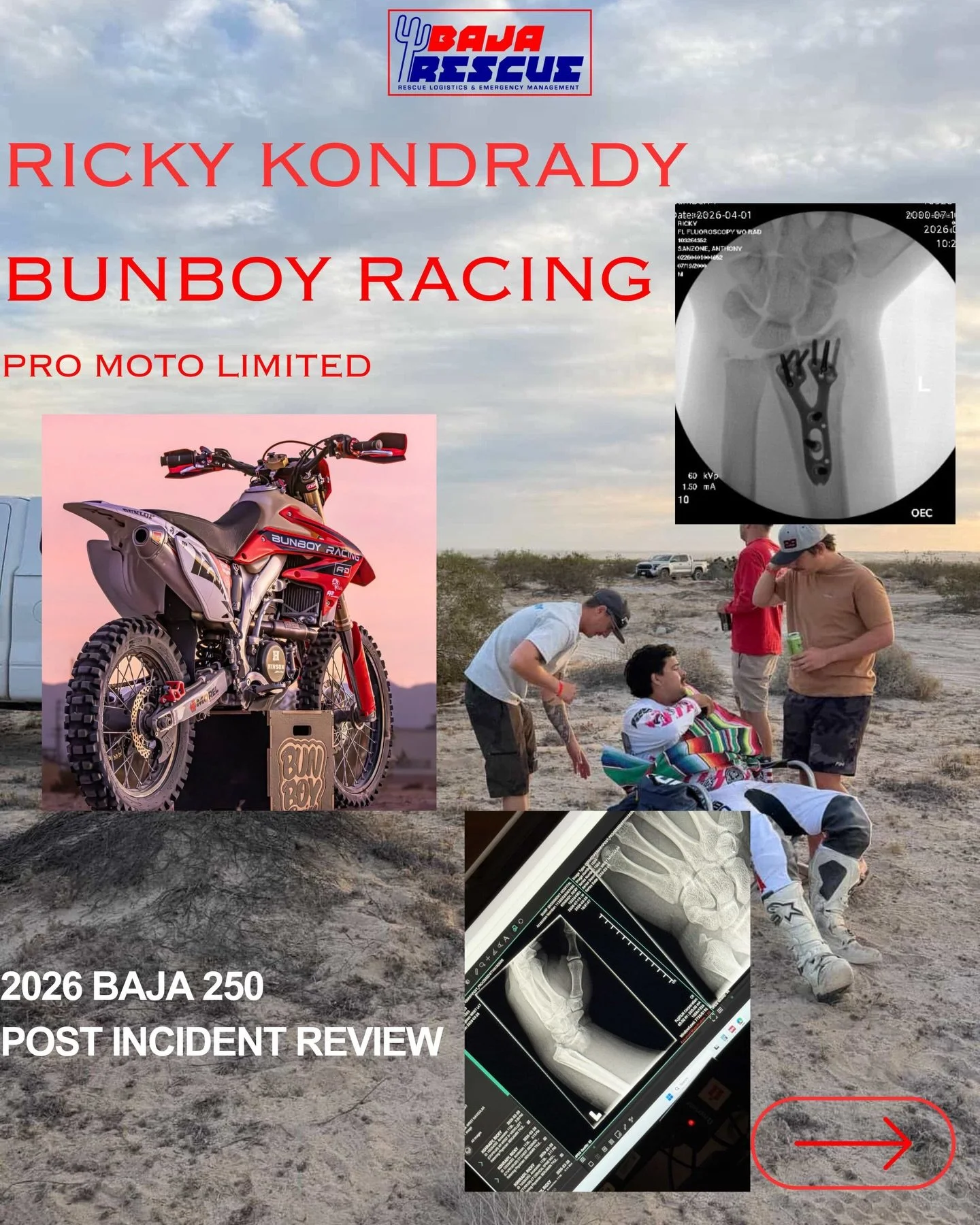 @rickykonrady had an unfortunate start to his 2026 @scoreinternational racing calendar. Just 9 miles into the San Felipe 250, Ricky swapped hard and went down. He was knocked unconscious for ~15 minutes and sustained a broken arm requiring surgery. O