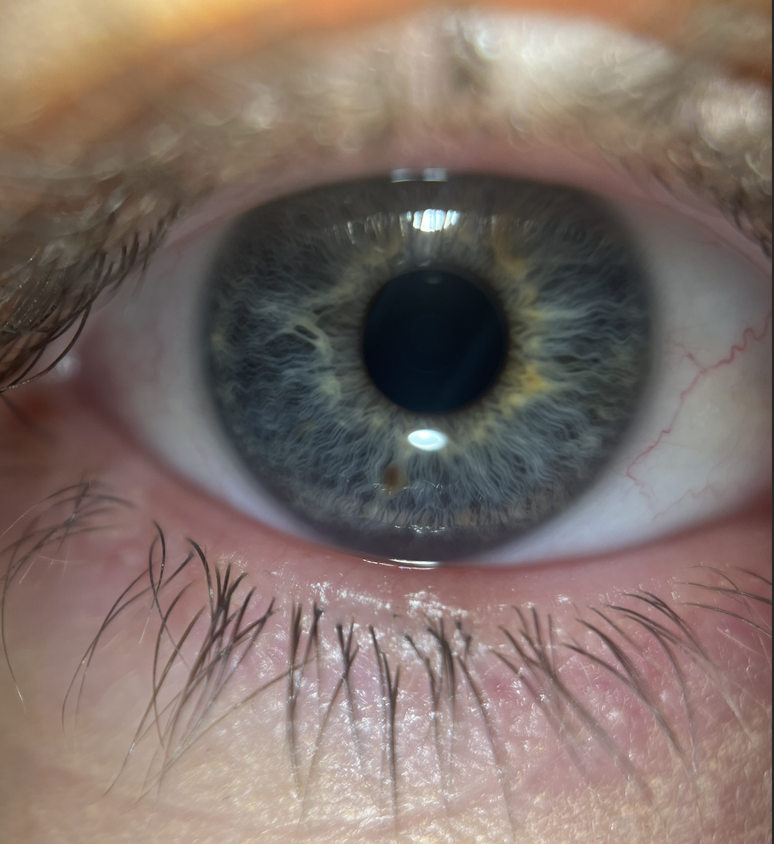 Close-up of a human eye showing the iris, pupil, eyelashes, and surrounding eyelid skin.