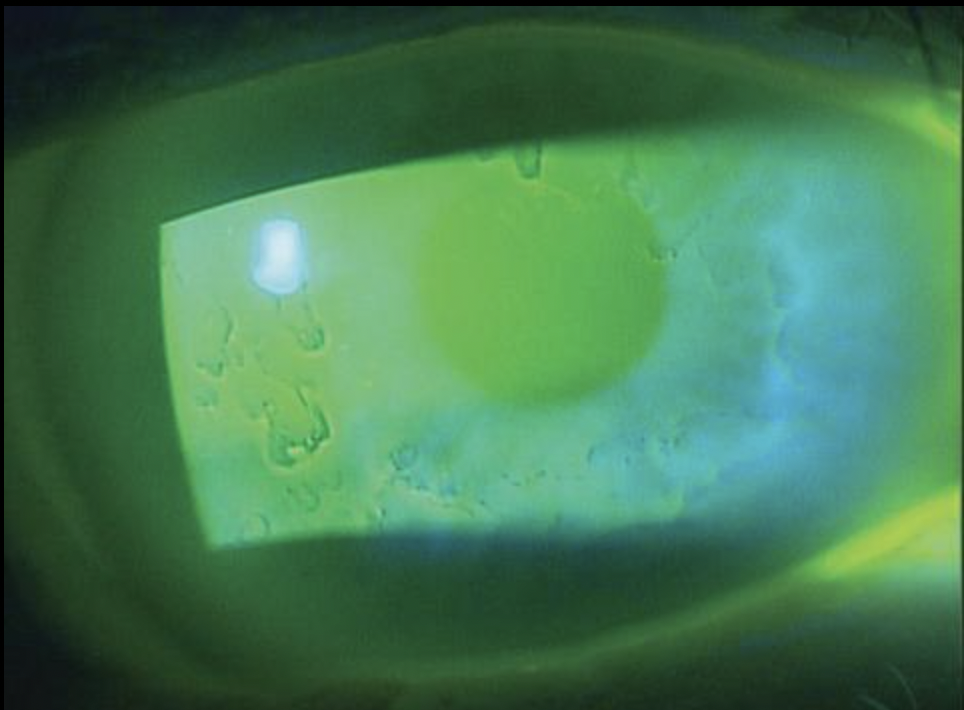 Green laser light projected onto a surface, creating abstract patterns and shapes.