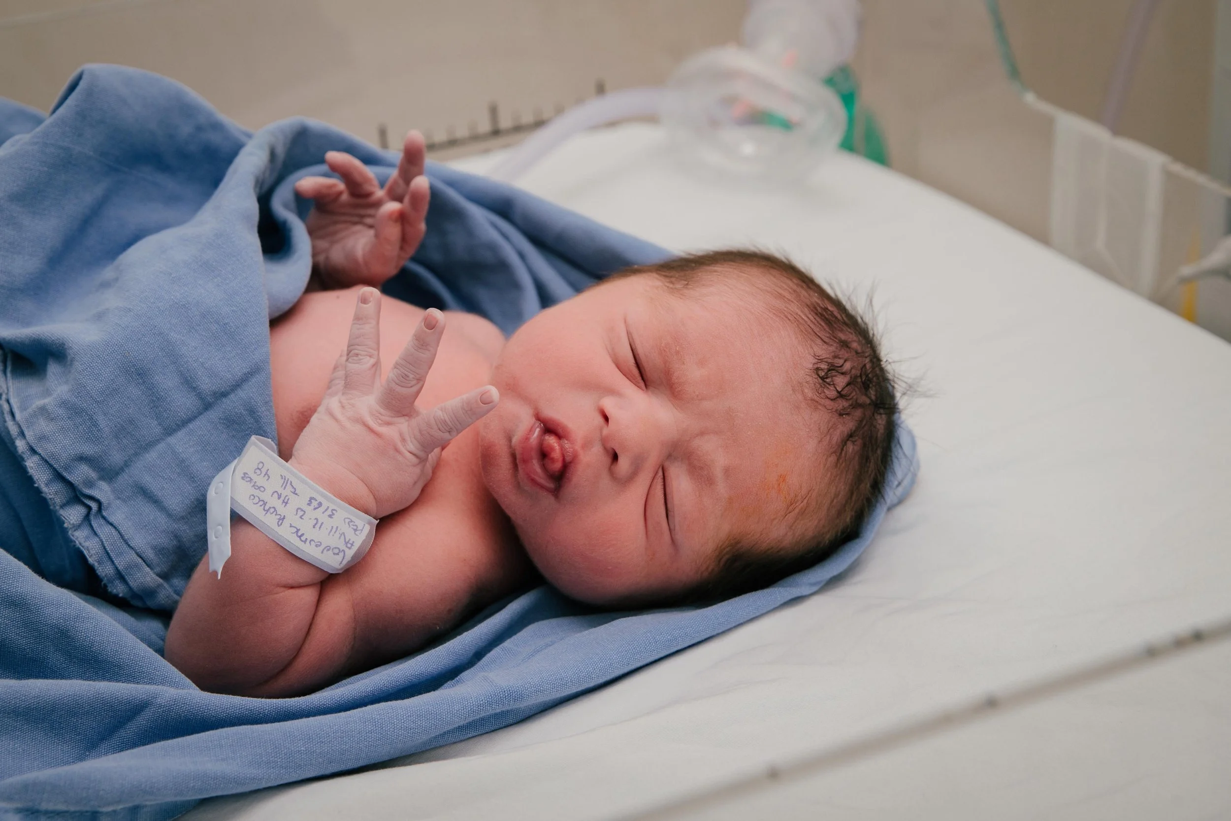 primera fotografia de Recién nacido acostado en una cama de hospital envuelto en una manta azul, con una pulsera de identificación en la muñeca, en un entorno hospitalario.