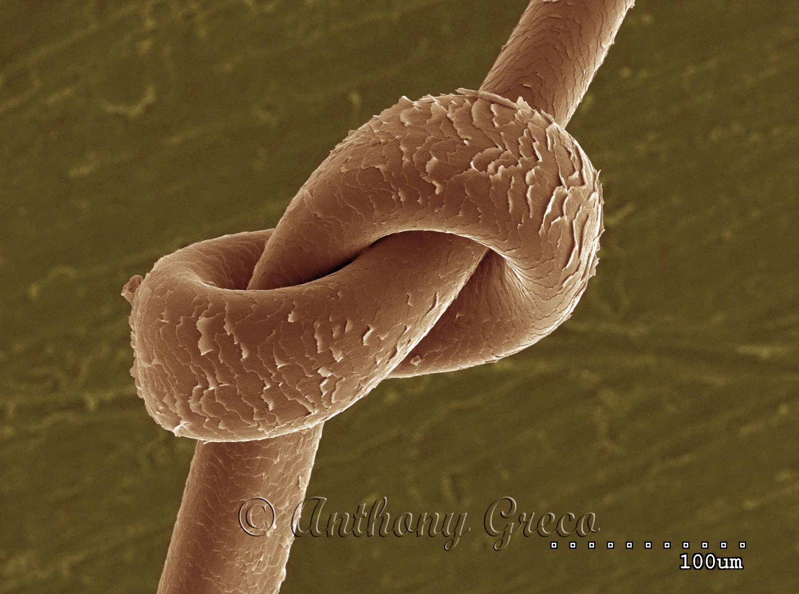 Knot in a human hair