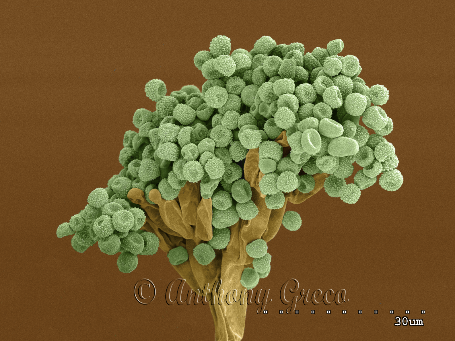 Mold showing abundant mold spores