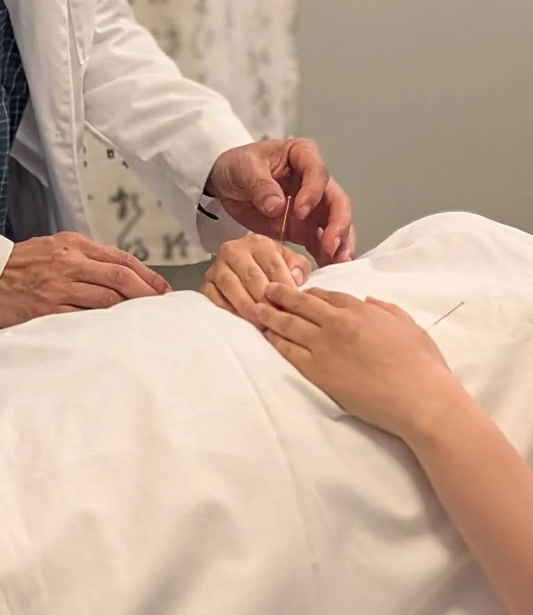 Traditional Acupuncture