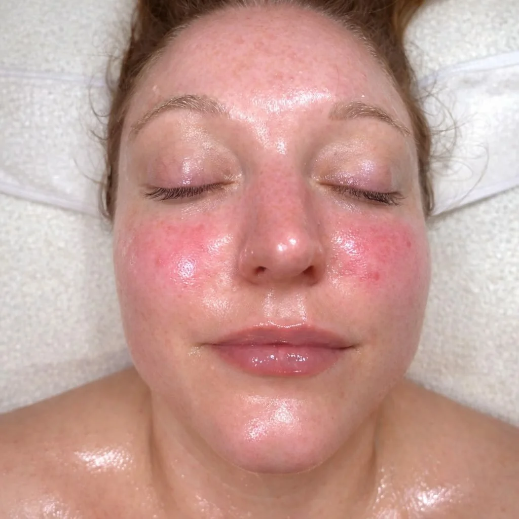 Dermaplan facial 😍