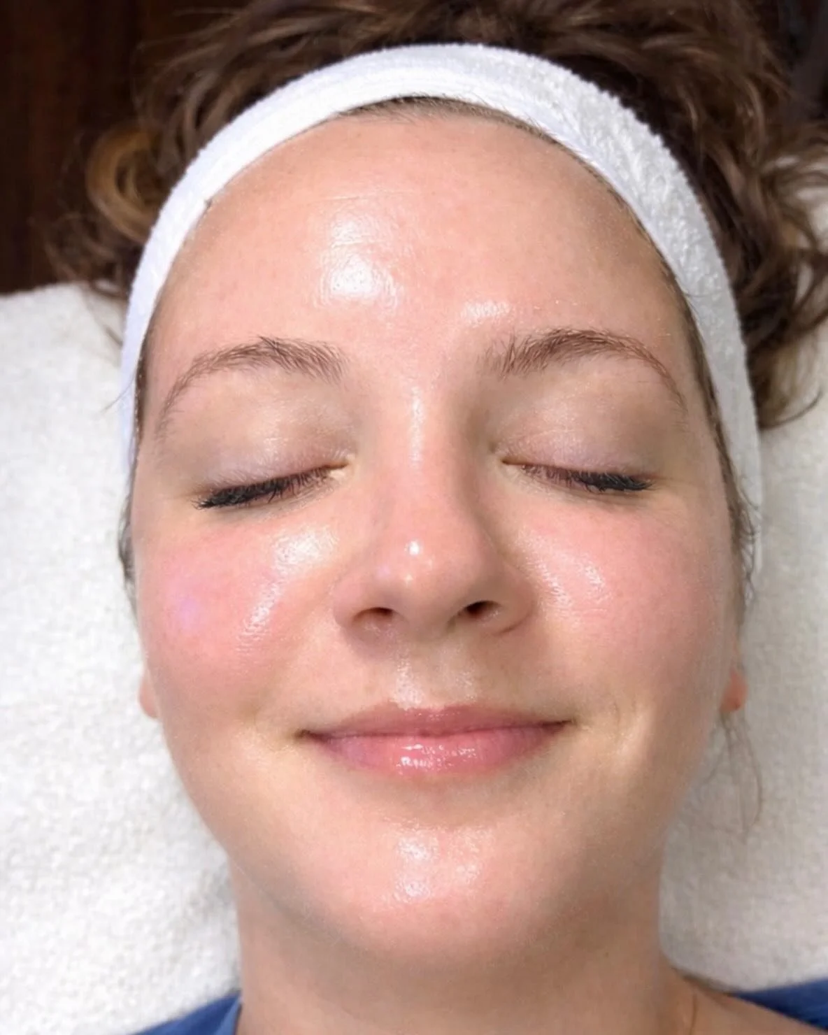 Hydrofacial Glow💦