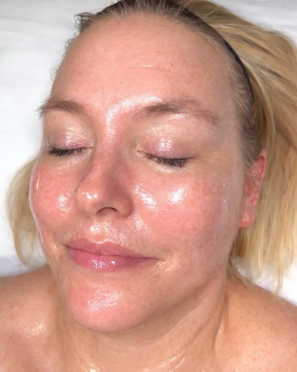 Glowing skin is always in 🤩