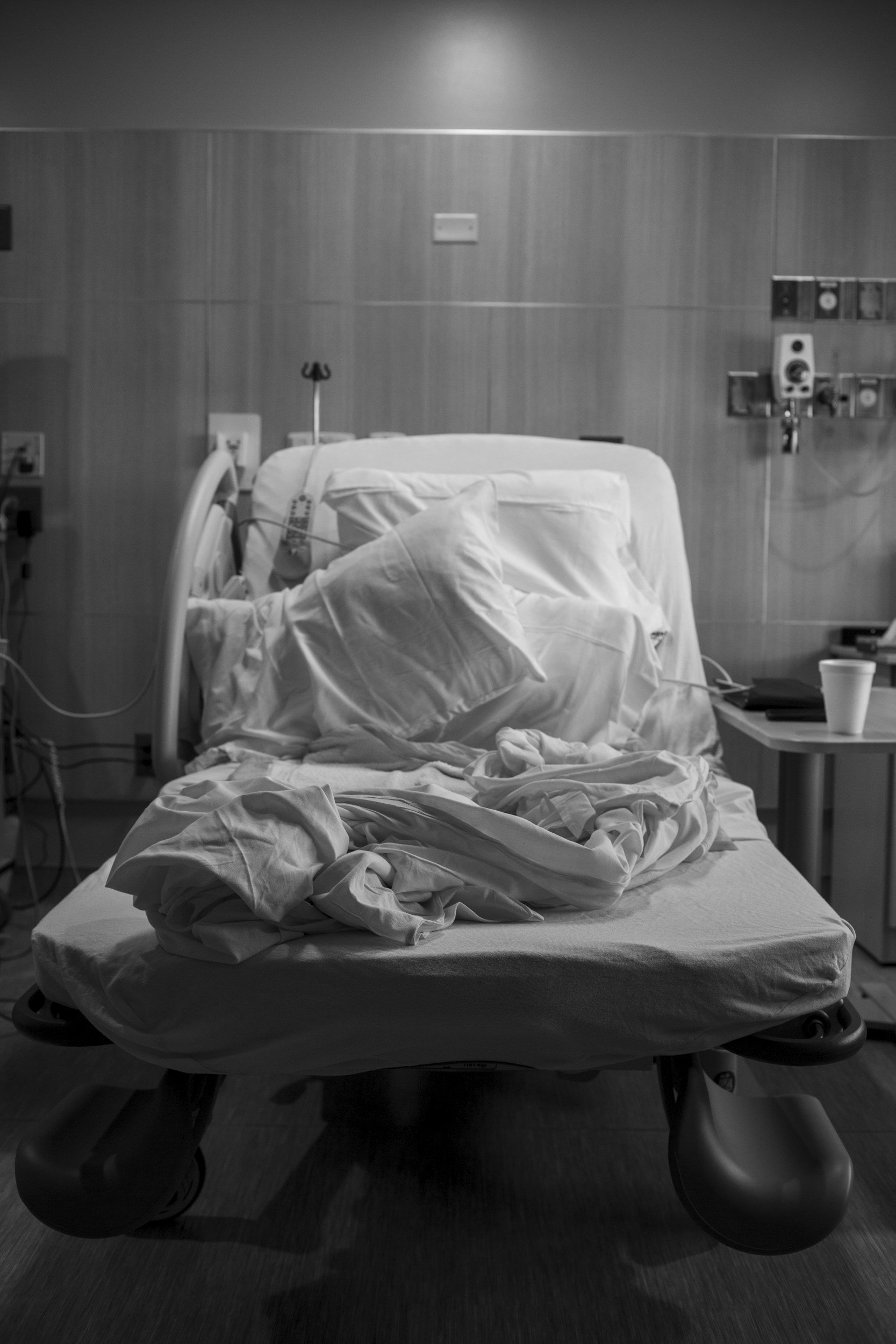 Empty hospital bed with disheveled sheets and pillows in a dimly lit room.