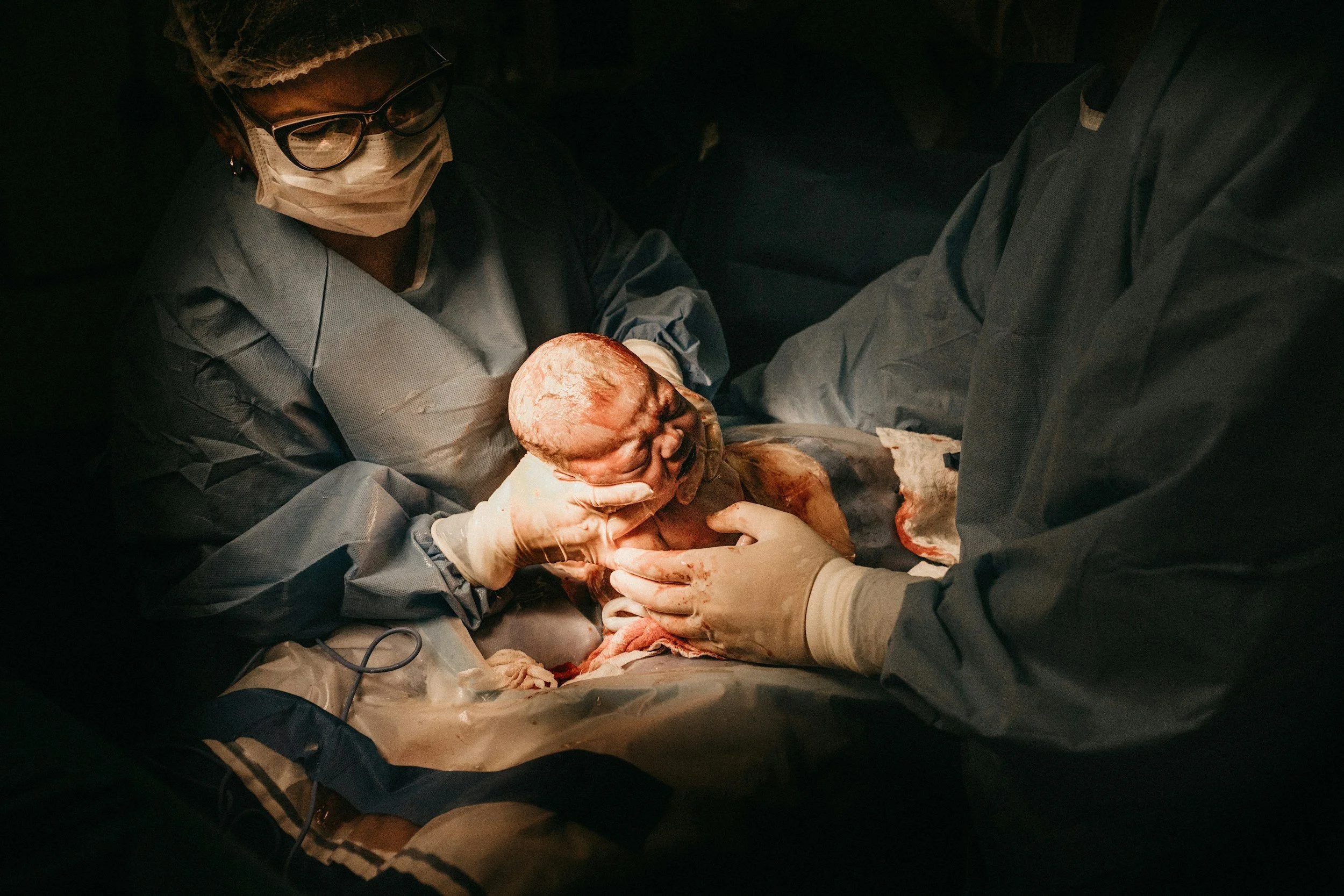 Healthcare professionals performing a delivery of a newborn baby in a darkened room, with the baby being held and examined by the medical team.