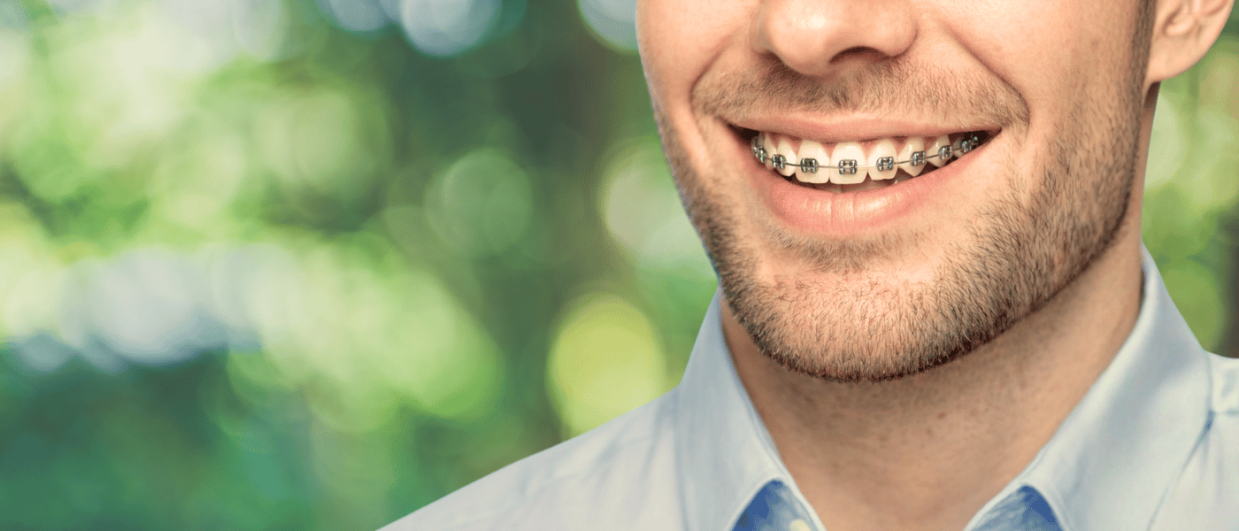 Close-up of a person's face showing a smile with braces on their teeth, against a nature background.