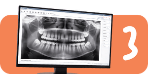 If appropriate, we may take X-rays to see how the jaws are developing and how the adult teeth are forming and coming in.