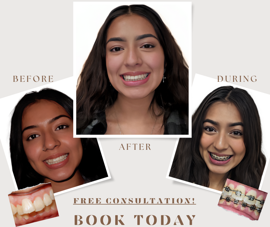 Emilia's Journey with Braces: Insights and Tips for Overcoming Orthodontic Anxiety
