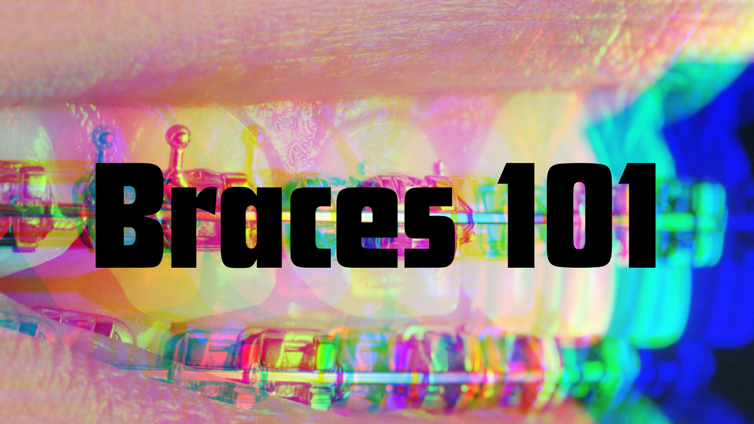 The Evolution of Braces: A Journey Through History