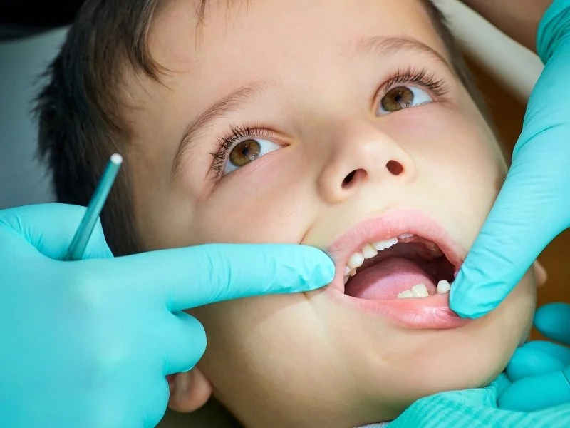 Child receiving dental check-up, with a dentist using gloves and a dental mirror.