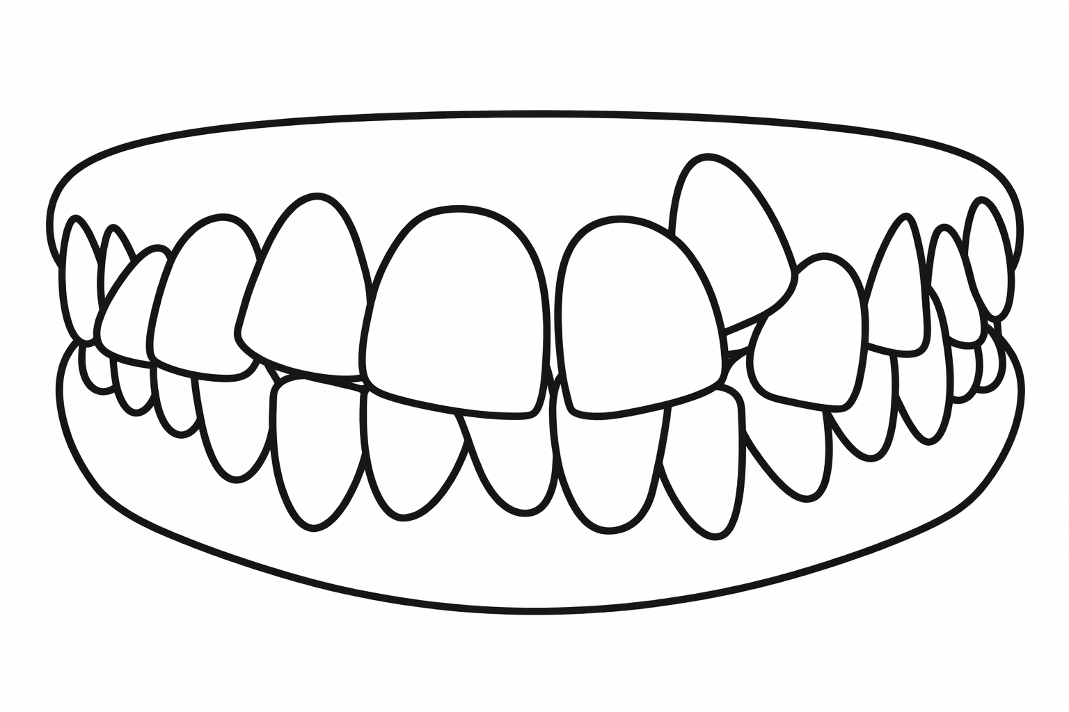 Crowding illustration