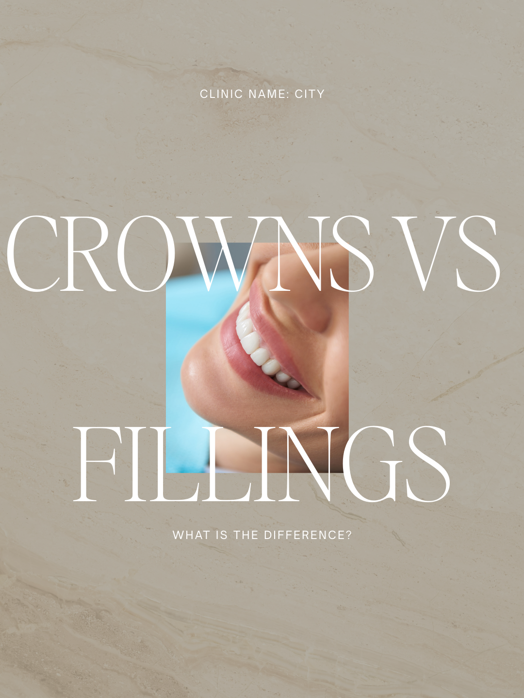 Crowns vs fillings — what’s the difference?