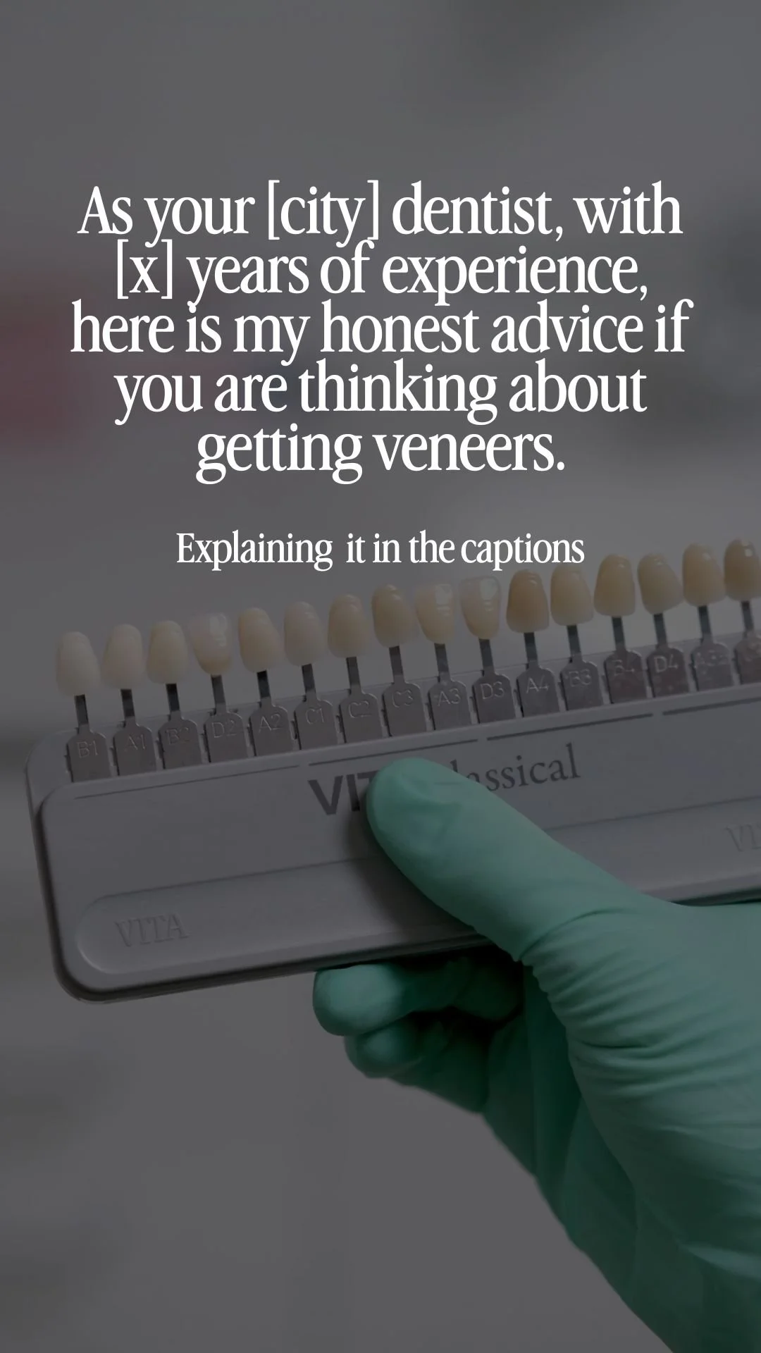 As your [city] dentist, with [x] years of experience, here is my honest advice if you are thinking about getting veneers.