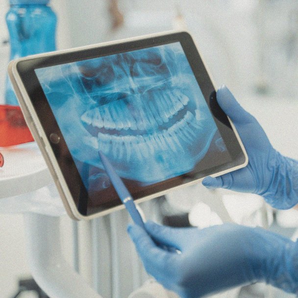 A dental professional wearing blue gloves holding a tablet displaying a digital X-ray of a person's teeth, with a stylus pointing to the X-ray image.