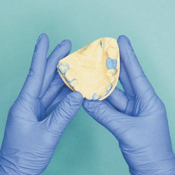 Person in blue medical gloves holds a dental impression tray with dental molds against a light blue background.