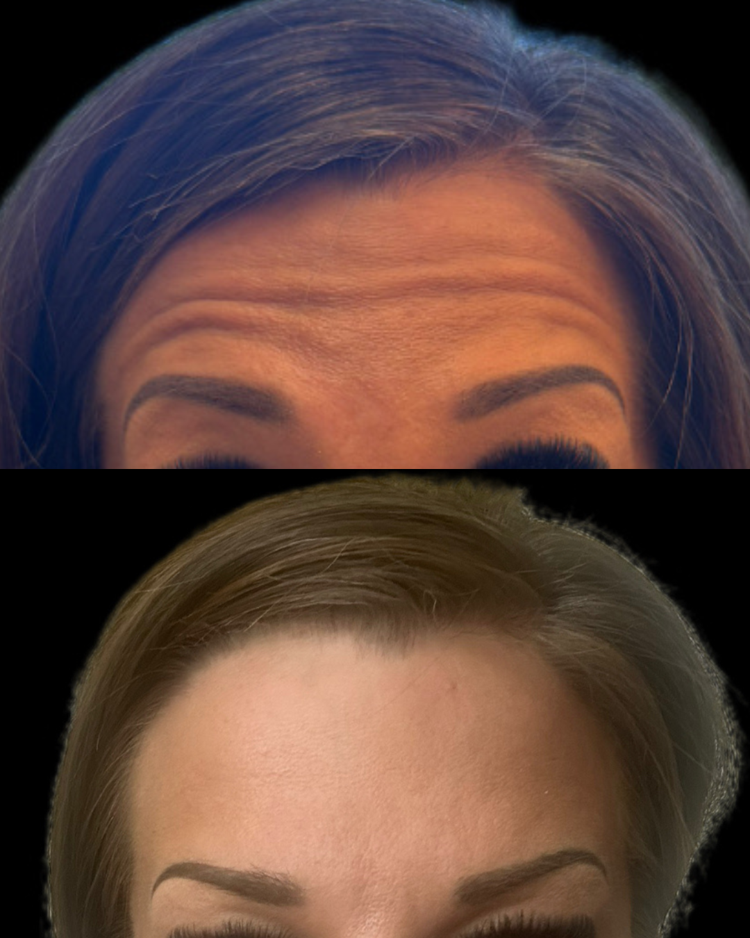 Palms_before_after_client2_forehead1.png