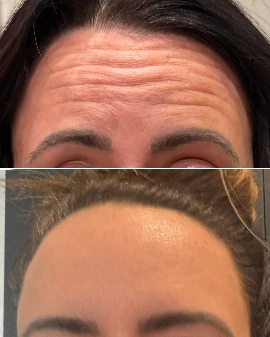 Beige Minimalist Beauty Before After Collage Instagram Post (3).png