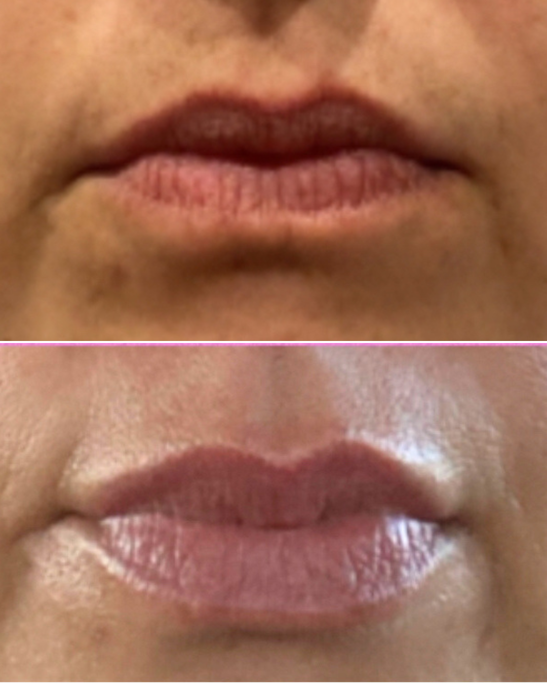 Beige Minimalist Beauty Before After Collage Instagram Post (4).png