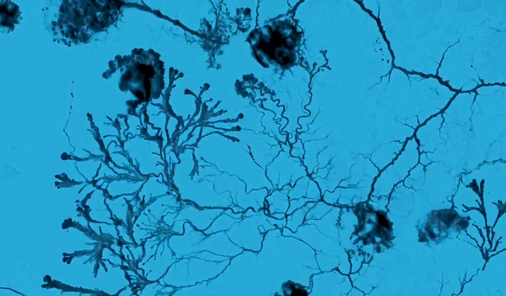 Physarum Polycephalum, Carolina Lombardi, artist, Rome