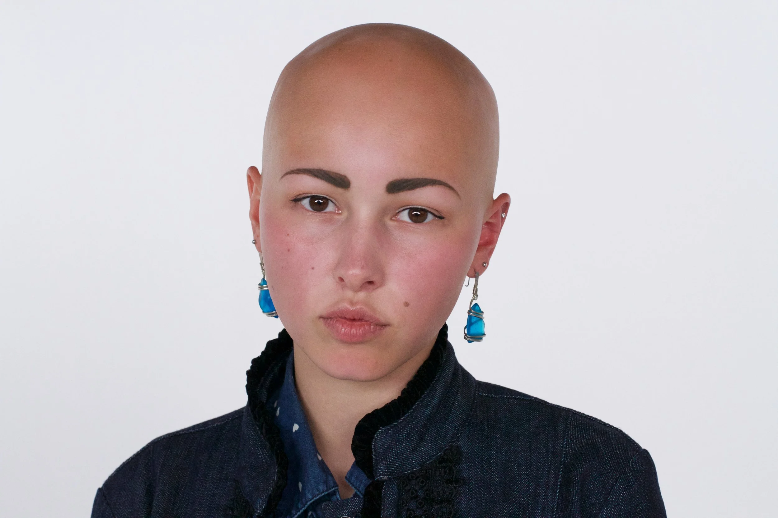 Dispelling Beauty Myths: Alopecia