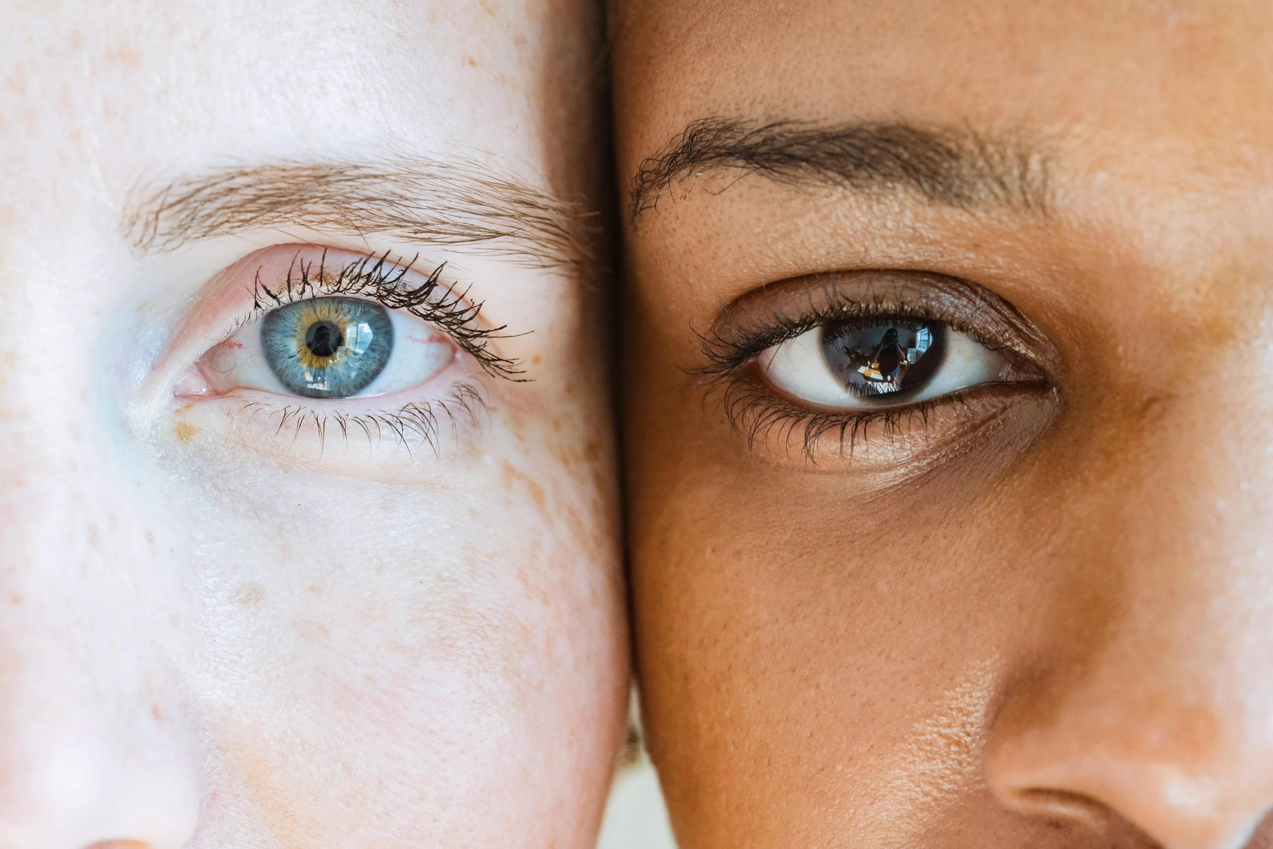 Close-up of two people's faces, showing one blue eye and one brown eye.