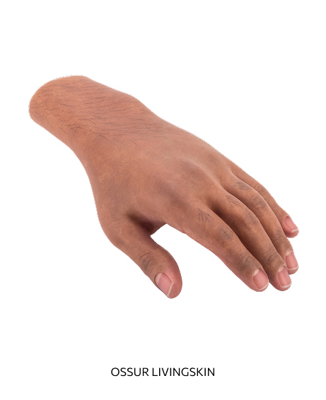 A Vancouver Prosthetics & Orthotics realistic silicone prosthetic hand with skin texture and fingernails, labeled 'Ossur LivingSkin'.