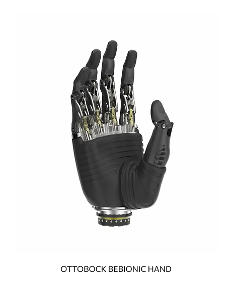 A Vancouver Prosthetics & Orthotics mechanical prosthetic hand with metal and plastic components, black fingers, and a wrist attachment labeled Ottobock Bebionic Hand.